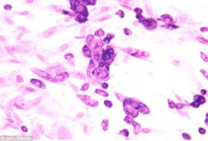 3519916200000578-0-researchers_found_that_the_herpes_virus_pictured_under_the_micro-a-20_1465502929265